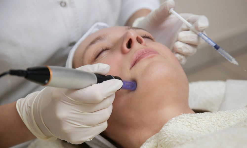 Benefits of Skin Needling: Reveal Radiant Skin
